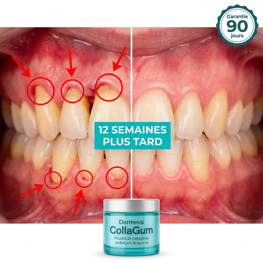 CollaGum™